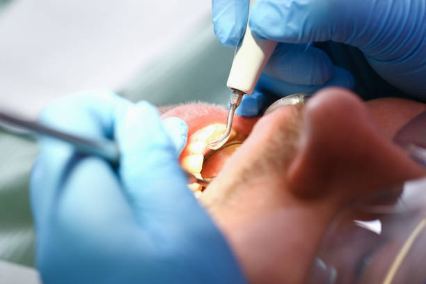 Best Dentist for Tooth Abscess  in Walnut Hill, TN